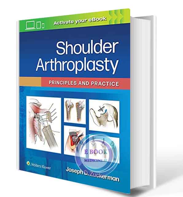 دانلود کتاب Shoulder Arthroplasty: Principles and Practice First Edition 2021 ( PDF)